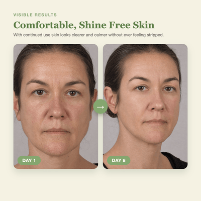 Olivine Cactox Pore Relief Jelly Toner Pads and Serum Mist Duo Day 1 to Day 8 visible results