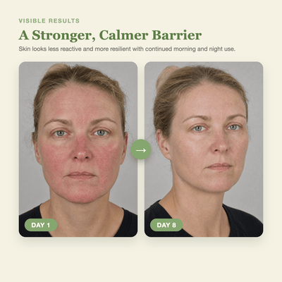 Olivine Matcha PDRN Calming Cream Day 1 to Day 8 visible results