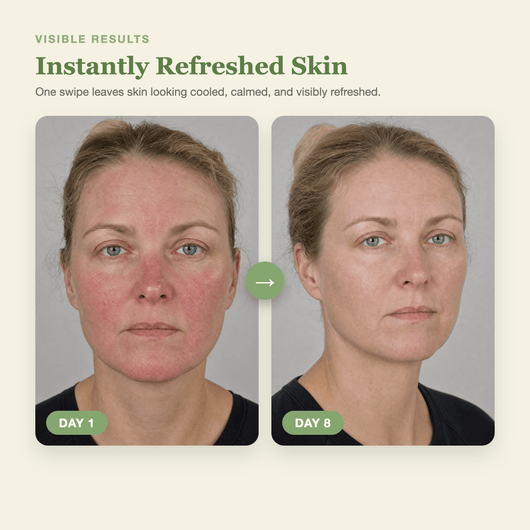 Olivine Matcha PDRN Tea Pad Day 1 to Day 8 visible results