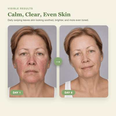 Olivine Matcha PDRN Tea Pad Day 1 to Day 8 visible results