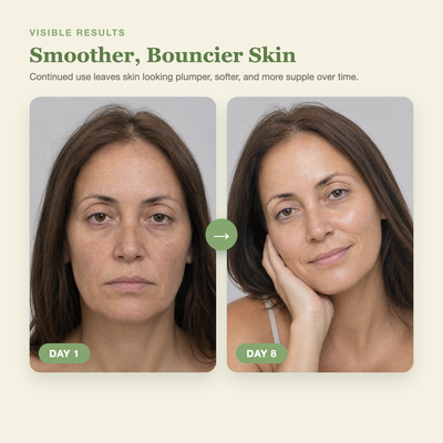 Olivine PDRN Hyaluronic Acid Cream Day 1 to Day 8 visible results
